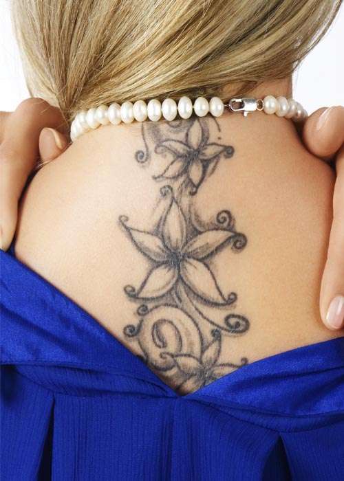 ... Tattoo Removal Services $228 Value from Precision Laser Tattoo Removal