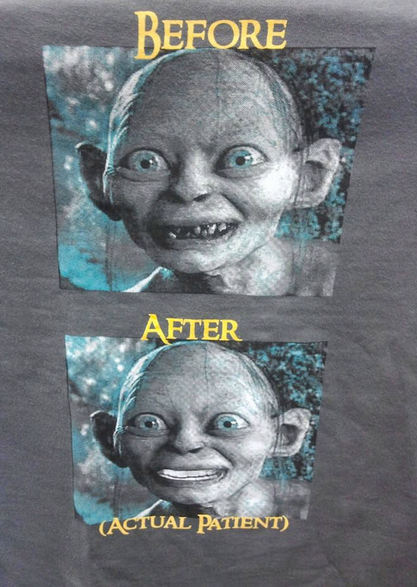 Name:  b4 after teeth.png
Views: 166
Size:  398.6 KB