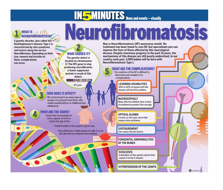 Name:  Neurofibromatosis in 5 minutes.jpg
Views: 707
Size:  138.0 KB