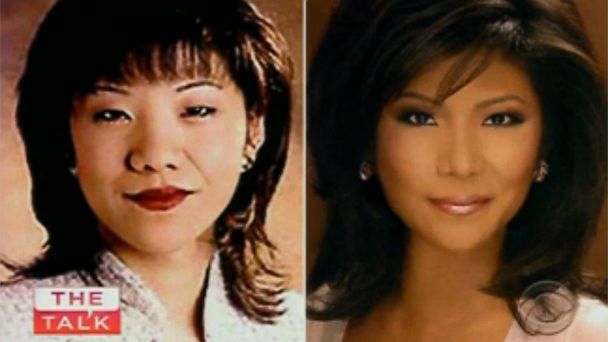 Name:  ht_julie_chen_plastic_surgery_ll_130912_16x9_608.jpg
Views: 2447
Size:  26.5 KB